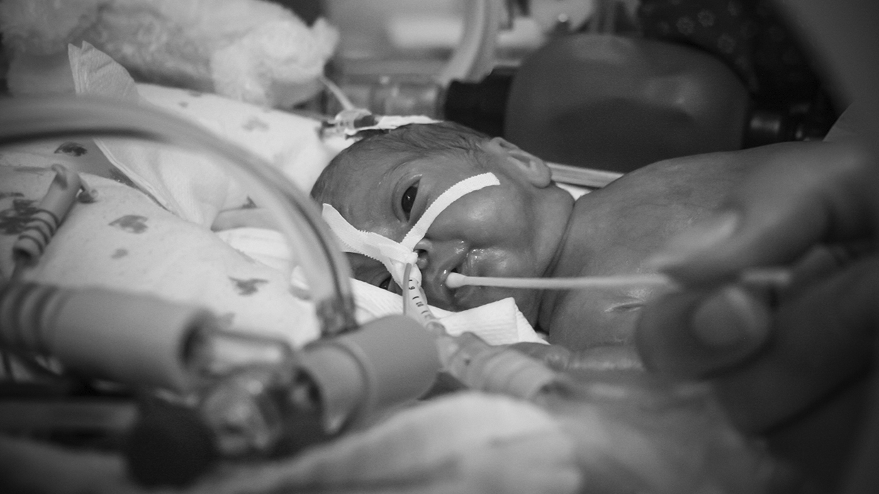 Neonatal Incubator Transport worldwide 24/7 Pediatric Air Ambulance